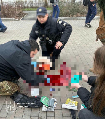 🕯У столиці померла 48-річна жінка, поранена під час російського обстрілу 23 грудня,— повідомляє Київська міська прокуратура