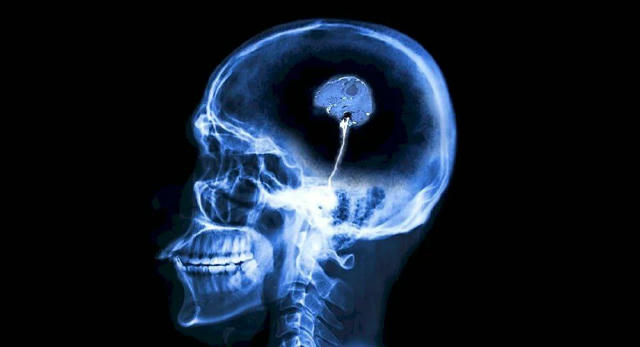 🧠Мозок чоловіків старіє набагато швидше за жіночий, але це можна звернути... відеоіграми, — вчені. Норвезькі дослідники з'яс