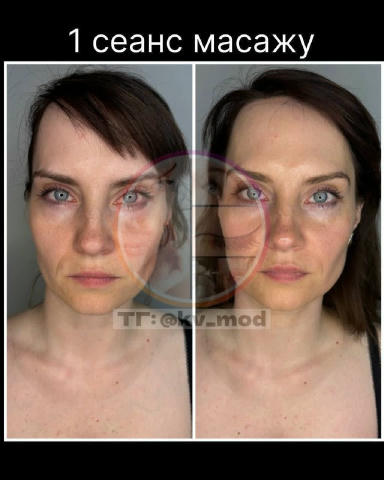 Масаж обличчя 🗓️Коли? на понеділок- 18.00🔥. 📍Де? м. Деміївська / Голосіївська 💰Скільки? 🔥Безкоштовно ❗️Шукаю модель 35-5